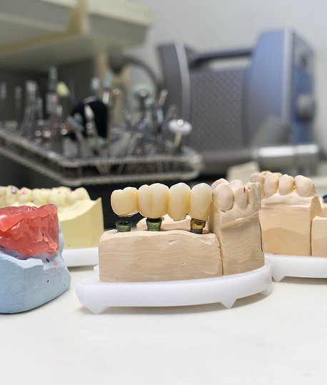 Dental crown and bridge models showing tooth restoration options at The Hamptons Dentist