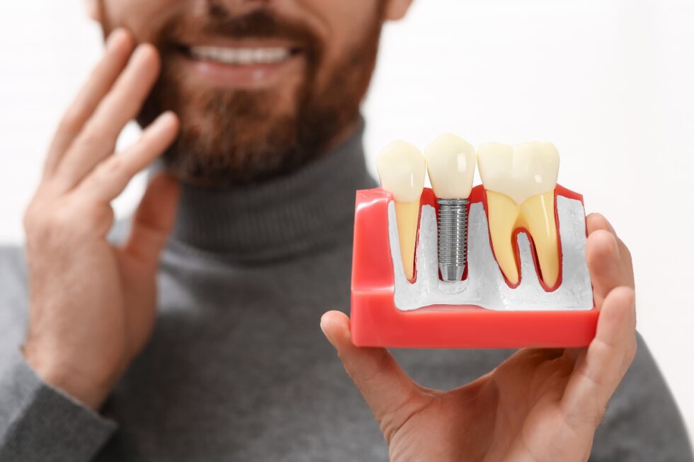 seafood after dental implants